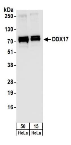 DDX17 Antibody, Novus Biologicals 0.1mL; Unlabeled:Antibodies, Polyclonal